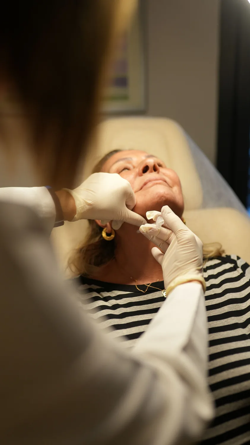 Aplicación médica facial de bioestimuladores realizada con técnica estéril