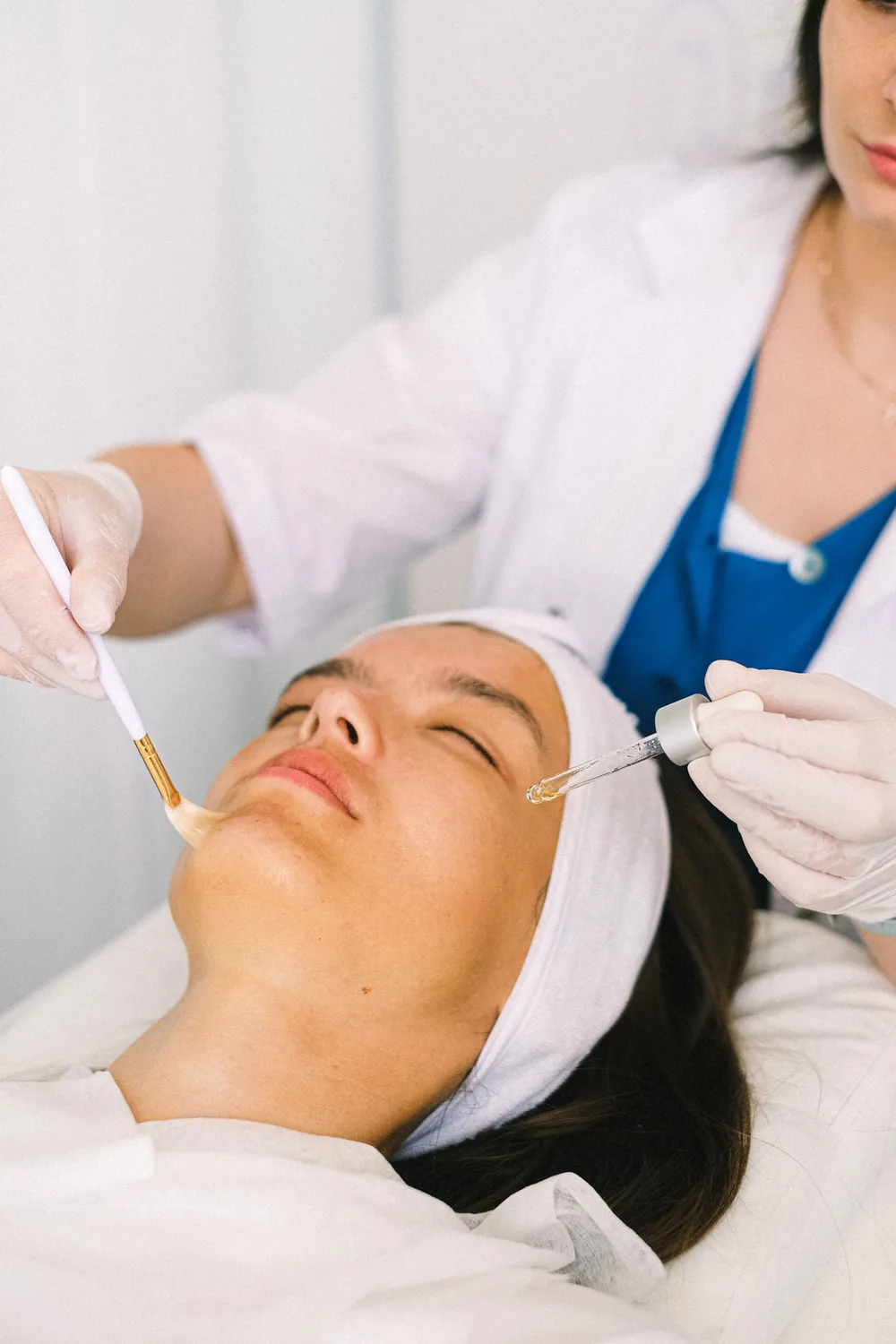 Aplicación con brocha de una solución de peeling médico controlado en el rostro
